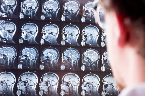頭と脳の Mri スキャン ぼやけたシルエットを持つ前景にある医師は 背景にある患者の脳の磁気共鳴画像を中心に見ている 神経内科または脳神経外科の概念画像 — ストック写真