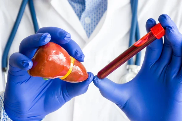 실험실 사진에 테스트 실험실 기술자는 혈액이있는 실험실 테스트 튜브에 한편으로는 — 스톡 사진