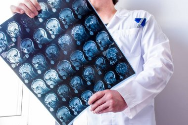 Nörolog veya beyin cerrahı dik mri beyin tarama görüntüleme tutarak ve merkezi sinir sistemi patolojileri için keşfetmek. Nöroloji ve nöroşirürjide Mr ve Ct tanısı fotoğraf konsepti