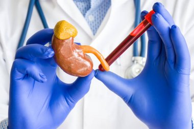 Laboratuvar tıbbi teşhis, böbrekler için testler, adrenal hormonlar konsept fotoğrafı. Doktor veya laboratuvar teknisyeni kan ile bir el laboratuvar test tüpü tutar, diğer taraftan - böbrek figürü