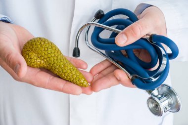 Kavram fotoğraf teşhis ve pankreas bezi hastalıklarının tedavisi. Doktor bir elinde beyaz laboratuvar önlüğü giymiş pankreas bezi figürü tutar, başka bir bükülmüş stetoskop fotoğraf yakın