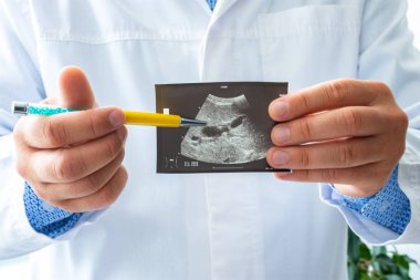 Doctor holds before itself and shows patient printed picture with ultrasound examination of gallbladder, pointing with a pen on gallbladder and its pathology. Concept photo ultrasonic  biliary system clipart
