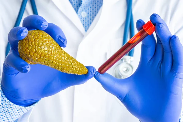 Laboratory medical diagnostics, tests and analysis for pancreas gland concept photo. Doctor or laboratory technician holds in one hand laboratory test tube with blood, in other - figure of pancreas