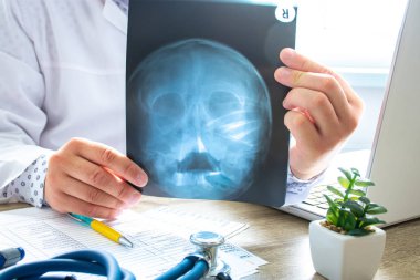 Doctor examines x-ray scan of head and skull near computer during work and patient advice in office. Diagnostics of diseases of ear, nose and throat, adenoids, abnormalities of skull, brain, bones clipart