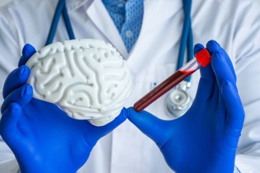 Laboratuvar tıbbi teşhisleri, beyin ve nörolojik sistem konsepti fotoğrafları için testler. Doktor ya da laboratuvar teknisyeni bir elinde kan ile test tüpü tutuyor.