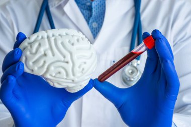 Laboratory medical diagnostics, tests for brain and neurological system concept photo. Doctor or laboratory technician holds in one hand laboratory test tube with blood, in other - figure of brain clipart