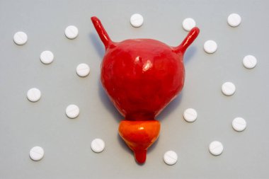 Anatomik orijinale karşılık gelen idrar kesesi ve prostatın modeli veya şekli gri arka planda polka noktalarıyla süslenmiş beyaz haplarla çevrilidir. Ürolojide kullanmak için fotoğraf