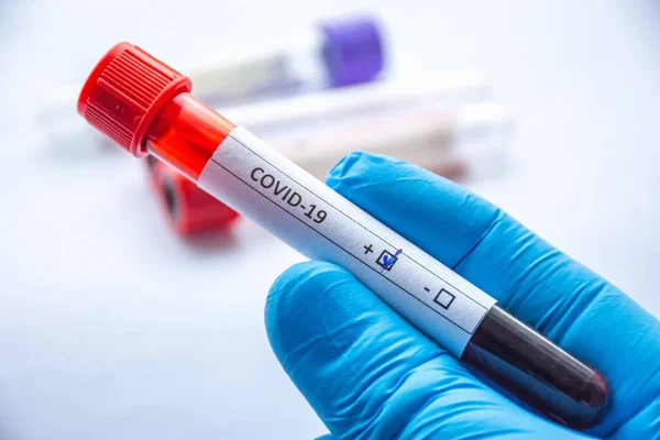 Laboratory Technician Medical Specialist Doctor Scientist Holds Blood Test Tube — Stock Photo, Image