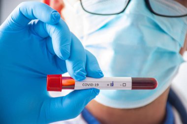 Tıbbi maskeli ya da gözlüklü doktor ya da bilim adamı elinde COVID-19 etiketli bir test tüpü tutuyor. Erken teşhis koronavirüsü kavramı laboratuvar kullanımı