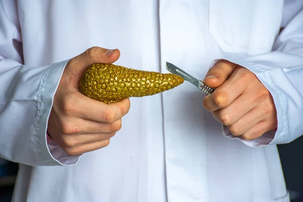 Surgeon held scalpel over anatomical model of human pancreas gland, holding it in his hand against background of body in uniform. Concept photo surgical treatment of pancreas ailments and procedures