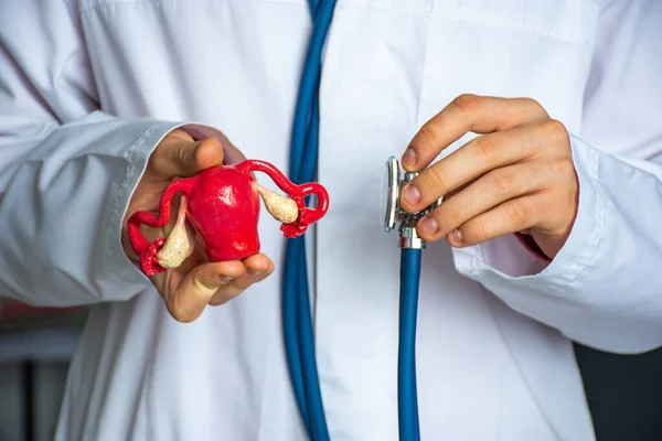 Läkare Gynekolog Eller Reproduktionsmedicin Specialist Håller Handen Figur Mänsklig Livmoder — Stockfoto