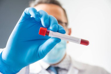 Doktor ya da laboratuvar asistanı elinde üzerinde kan bulunan bir laboratuvar tüpü ve yapılacak analizin metnini girmek için temiz bir yer tutuyor. Hormon teşhisi için konsept fotoğraf
