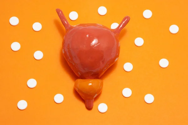 Model or figure of urinary bladder and prostate, which corresponds to anatomical original is located in orange background surrounded by white pills ornamented in polka dots. Photo for use in urology