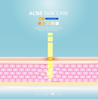 sivilce lekesi sorunlu vektör tasarımı.