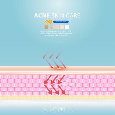 sivilce lekesi sorunlu vektör tasarımı.