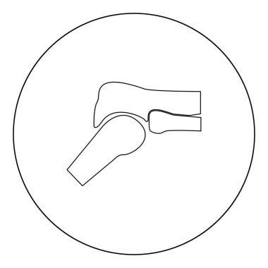 Diz eklem simge siyah renk daire vektör çizim