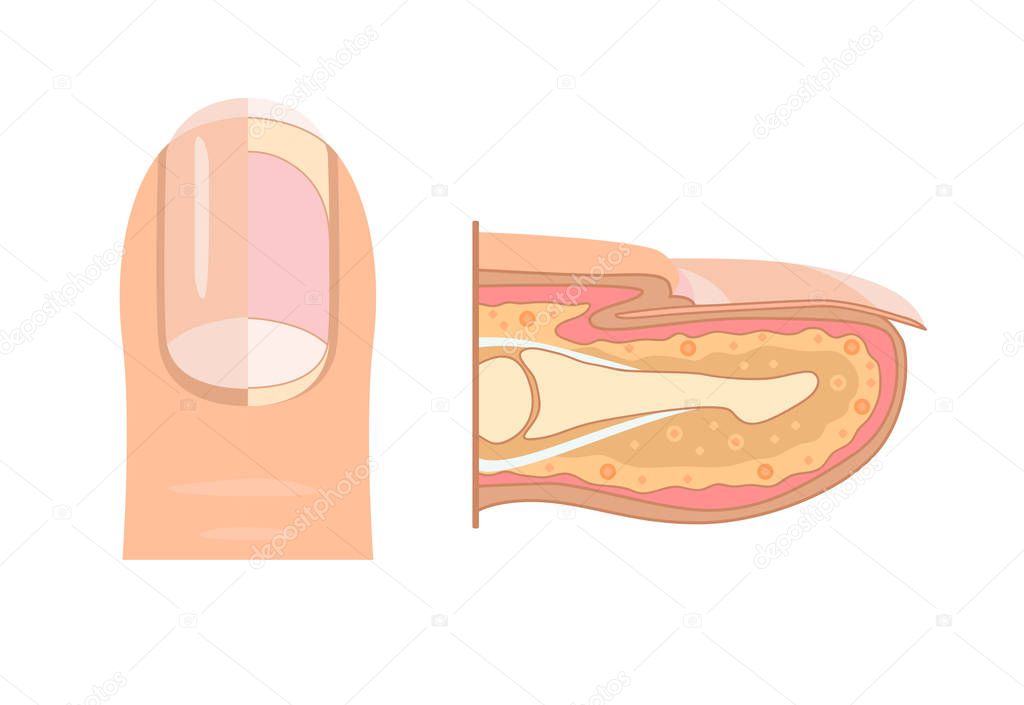 Anatomy of human finger nail. Medical diagram of the structure of the inside cross-section of the fingers. Vector infographic concept isolated on white background