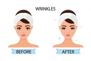 Kızın yüzünde kırışıklıklar var. Öncesi ve sonrası. Cilt bakımı kavramı, saf ve sağlıklı cilt. Vektör çizimi.
