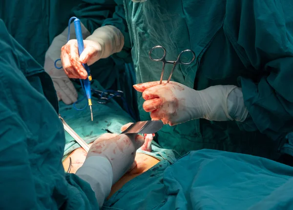 Cropped Shot Medical Team Performing Surgical Operation Operating Room Operating — Stock Photo, Image