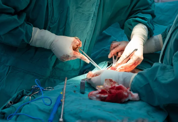 Cropped shot of medical team performing surgical operation in operating room. An operating room may be designed and equipped to provide care to patients.