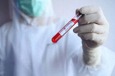 Bilim adamı doktor 2019 nCoV analizi için üzerinde kan olan bir test tüpü tutuyor. Solunum koronavirüsü hastalığı 2019 (COVID-19) için laboratuvar testi kavramı).