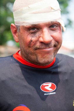 Pointnoire/Kongo - 18 Mayıs 2013 - yaralı rugby oyuncusu ifade portresi