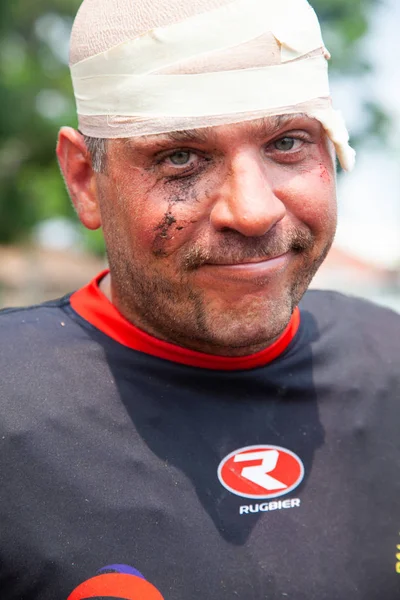 Pointnoire/Kongo - 18 Mayıs 2013 - yaralı rugby oyuncusu ifade portresi