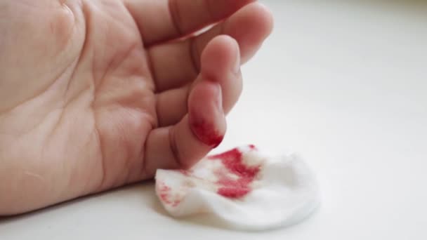 The blood flowing out of the wound on the womans little finger close-up — Stock Video