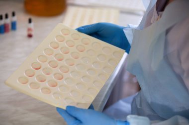 Kan testi. Kan tip kontrol