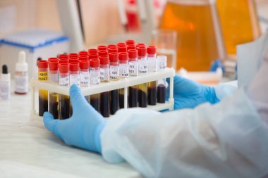 Kan testi. Kan testi tüpler