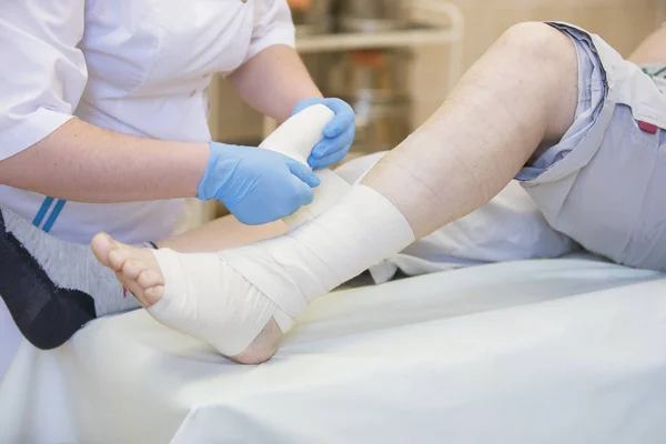 Nurse Bandages Leg Fracture Human Lower Limbs Treatment Broken Bones — Stock Photo, Image