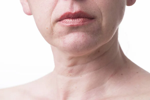 Furrowed Lips Mature Woman Signs Aging Skin — Stock Photo, Image