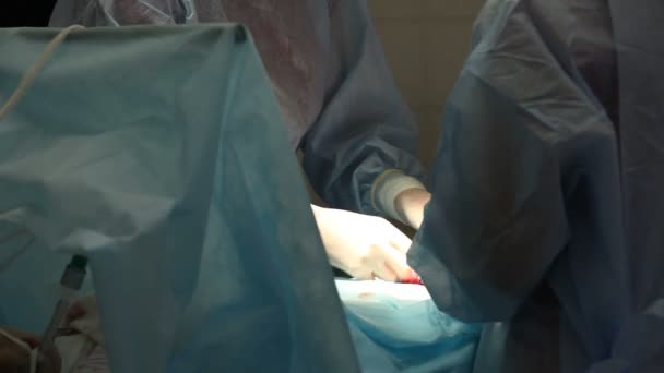 Chirurgenhände Handschuhen Nähen Die Wunde Operationssaal — Stockvideo