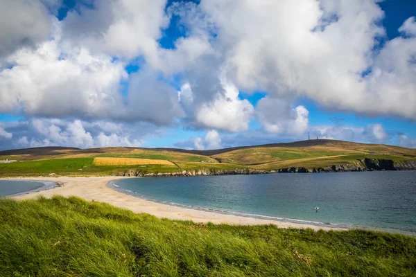 Escocia Islas Shetland Ninian Beach Tombolo Una Forma Terrestre Deposición — Foto de Stock