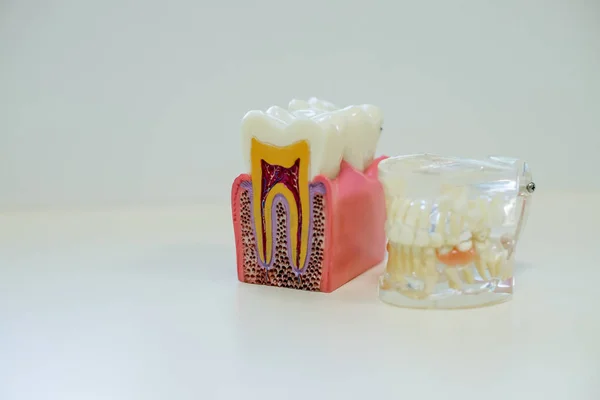 Vita tänder och tand modell utan karies på vit bakgrund. Tandvård-konceptet. — Stockfoto