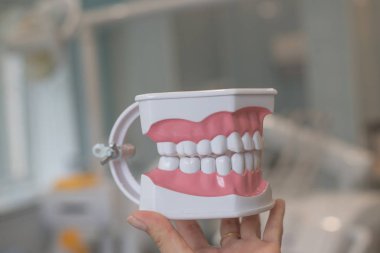 Mükemmel düz dişler. Modeli çene, yakın çekim. Diş telleri üzerinde teeth.teeth modeli takma dişler, Stomatology appointment.dental sağlığı uzmanı Check-up konsepti ile diş hekimi, diş protez modeli. Düzenli kontrolleri
