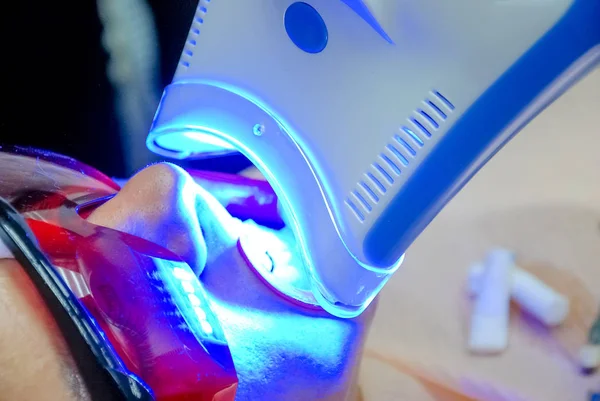 Femme adulte recevant une procédure de blanchiment des dents.portrait d'une patiente chez le dentiste de la clinique. Procédure de blanchiment des dents avec une lampe UV à lumière ultraviolette. Lampe LED pour procédure de blanchiment des dents — Photo