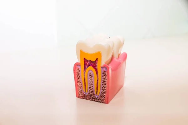 Modelo dentário sem cárie, cárie dentária em consultório odontológico. Conceito de dentes saudáveis. dentista infantil. Espaço de cópia — Fotografia de Stock