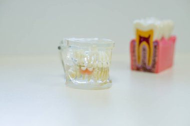 diş ve diş ayna, sembol fotoğraf takma dişler, tanı ve copayment. Sınıf eğitim .tooth diş hekimliği öğrenci öğrenme öğretim modeli gösterilen diş, kökleri, dişeti, diş eti hastalığı için diş modeli