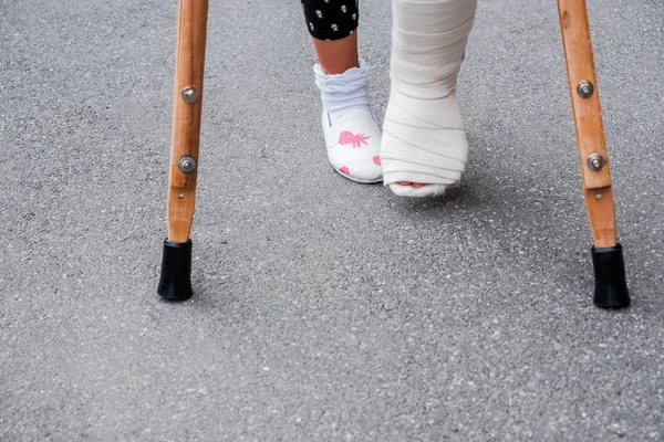 Fiatal lány ortopéd leadott mankók séta az utcán az út közelében. Gyermek egy törött lábát mankó, boka sérülés. Csonttörés és boka törés a gyermekeknél — Stock Fotó