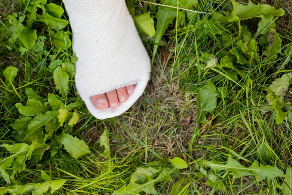 緑の草の上に子供の1つの白い石膏の脚。屋外でアクティブなゲーム。脚の石膏。事故の結果トランポリンの悪いジャンプ.安全規制の不遵守 — ストック写真