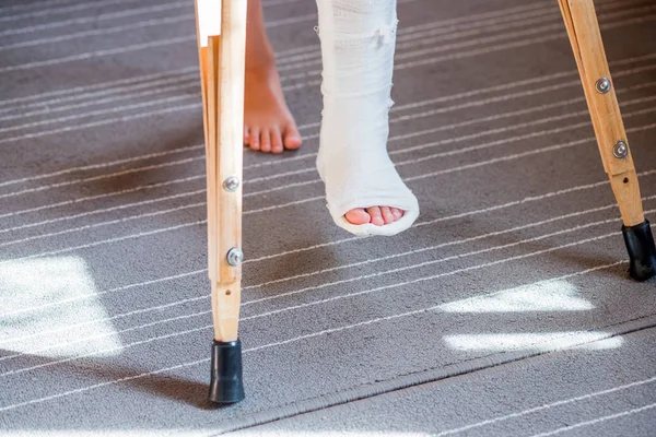 Pierna rota en yeso de niño irreconocible.Muchacha joven en yeso ortopédico en muletas en casa. Niño con una pierna rota en muletas, lesión en el tobillo. Fractura ósea y de tobillo en niños . — Foto de Stock