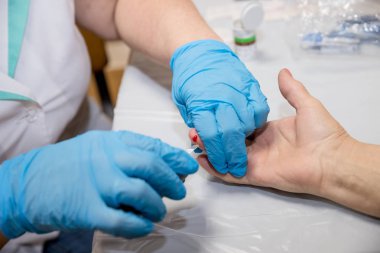 Glucometer ile Glikoz Düzeyi Kan Testini Ölçen Hasta Elleri. Glikoz seviyesinin ölçülmesi, test. Doktor şeker hastalığı için klinikte kan şekeri testi yapıyor. Doktor hastanede hastalarının kanını test ediyor.