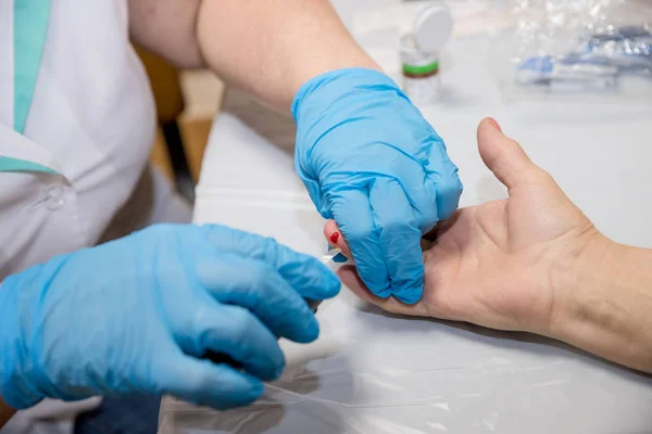 Glucometer ile Glikoz Düzeyi Kan Testini Ölçen Hasta Elleri. Glikoz seviyesinin ölçülmesi, test. Doktor şeker hastalığı için klinikte kan şekeri testi yapıyor. Doktor hastanede hastalarının kanını test ediyor.