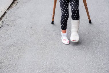 Kırık bacaklı çocuk sokaklarda koltuk değnekleriyle dolaşıyor. Tatilde, okul tatilinde bacağı kırık bir çocuğu gösteren kavramsal fotoğraf. Ayaklarından yaralanan kızın asfalt üzerinde koltuk değnekleriyle bandajı var.