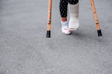 Kırık bacaklı çocuk sokaklarda koltuk değnekleriyle dolaşıyor. Tatilde, okul tatilinde bacağı kırık bir çocuğu gösteren kavramsal fotoğraf. Ayaklarından yaralanan kızın asfalt üzerinde koltuk değnekleriyle bandajı var.