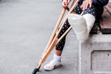 Tanınmayan bir kız, kırık bir bacak ve koltuk değnekleriyle sokakta oturuyor. Koltuk değnekleriyle engelli bir kız. Trambolinde atlarken kaza geçirmiş. Ayak bileği kırığı..