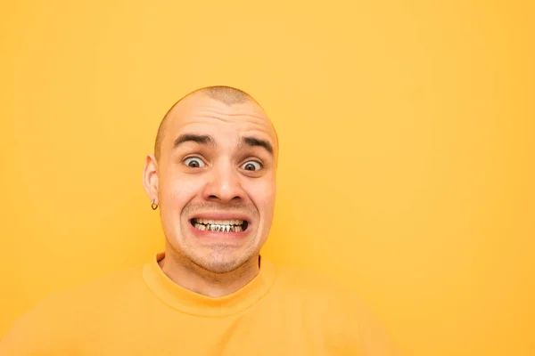 Nahaufnahme Porträt des Verrückten vom Grill auf den Zähnen macht ein komisches Gesicht und schaut schockiert in die Kamera auf gelbem Hintergrund. Verrückter junger Mann mit Fuchskopf in gelber Kleidung — Stockfoto