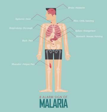 Sıtma Infographic düz tasarım alarm işaretleri. İnsan vücudu, iskelet ve organ ayarla sıtma hastalığı belirti kutsal kişilerin resmi. Vektör çizim.