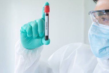 Laboratuvarda veya laboratuarda laboratuvar, tıbbi, kimya, sağlık, araştırma konsepti alanlarında kovid-19 virüsü aşısı geliştirmek ve analiz etmek için kan testi tüpü üzerinde çalışan Asyalı bilim adamı. Deneysel bilim